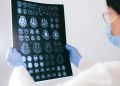 Alzheimer: femeile primesc diagnosticul cu aproape 3 ani mai târziu decât bărbații