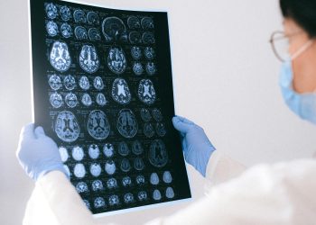Alzheimer: femeile primesc diagnosticul cu aproape 3 ani mai târziu decât bărbații